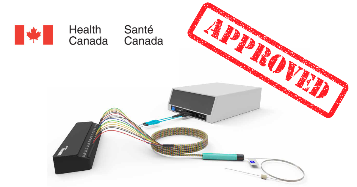 We are thrilled to announce that Health Canada has approved thermocoagulation procedures as an extension of the intended use of our depth electrodes. This is a game changer in the fight against drug-resistant epilepsy in Canada! Dixi medical becomes the first and only brand to offer a secure environment for Canadian clinicians wanting to improve their diagnostic procedures to localize epileptic foci and include thermocoagulation in their treatment options. Our clinical support team will join forces with our local distributor Neurosource Medical to carry on appropriated training and education about this technique.