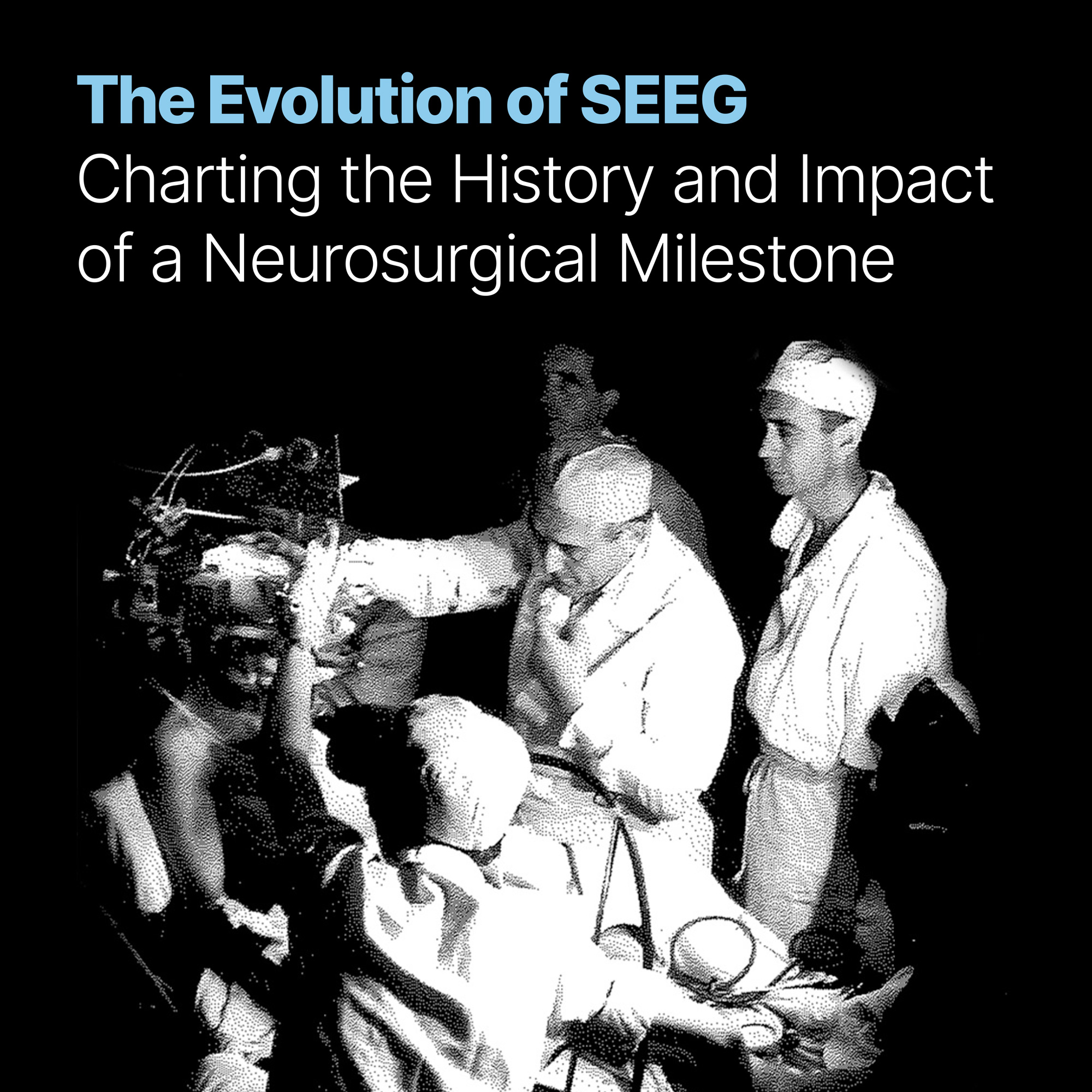 The Evolution of SEEG: Charting the History and Impact of a Neurosurgical Milestone
