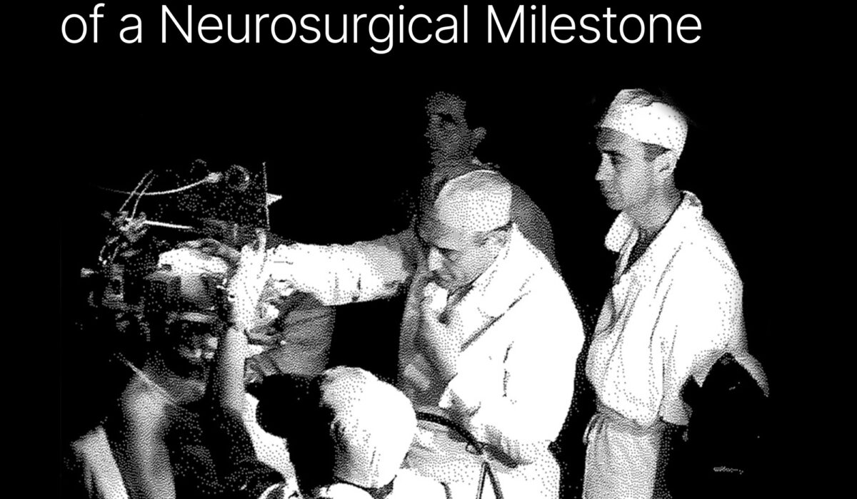 The Evolution of SEEG: Charting the History and Impact of a Neurosurgical Milestone